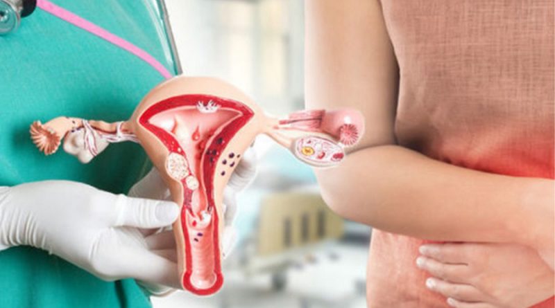 Причини та лікування дисплазії шийки матки