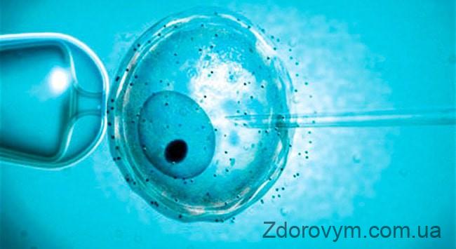 ЕКЗ (екстракорпоральне запліднення)