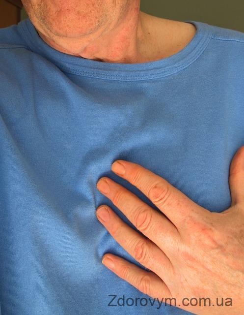 Симптом інфаркту міокарда