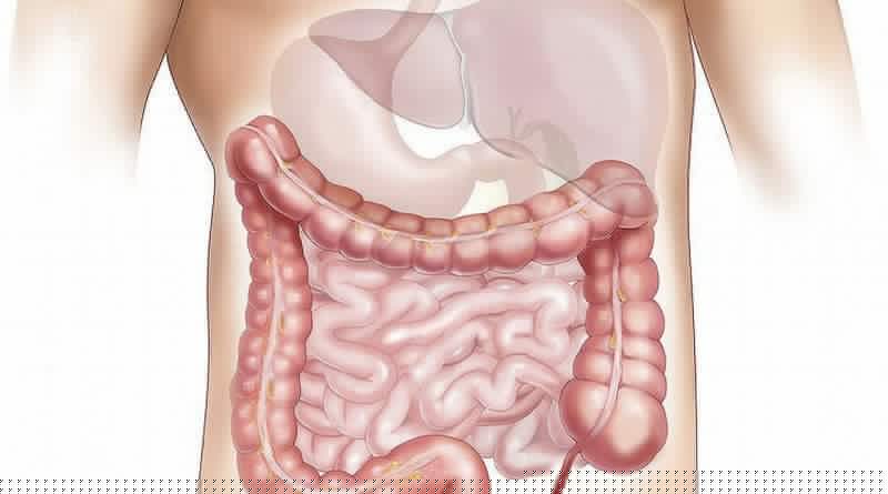 Цироз печінки