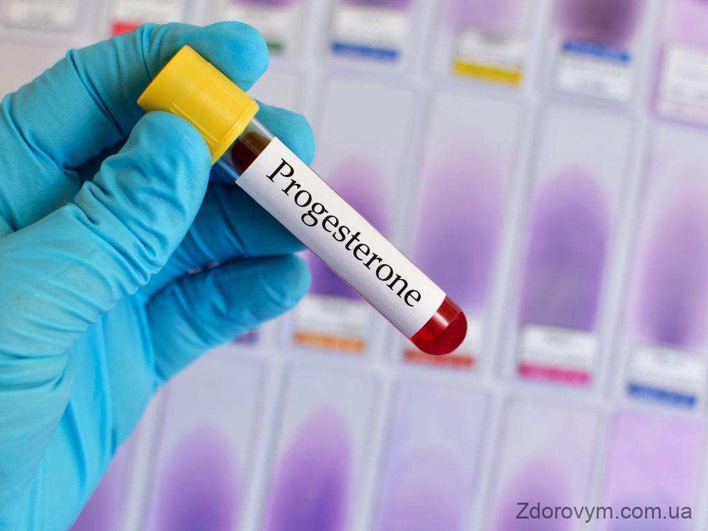 Коли краще здавати аналіз крові на прогестерон