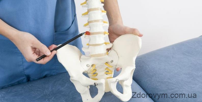 Можливі причини болю у спині