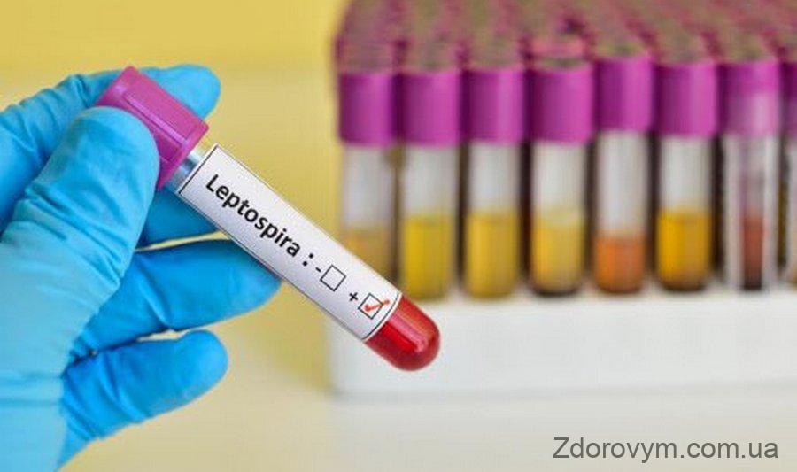 Тест на лептоспіроз