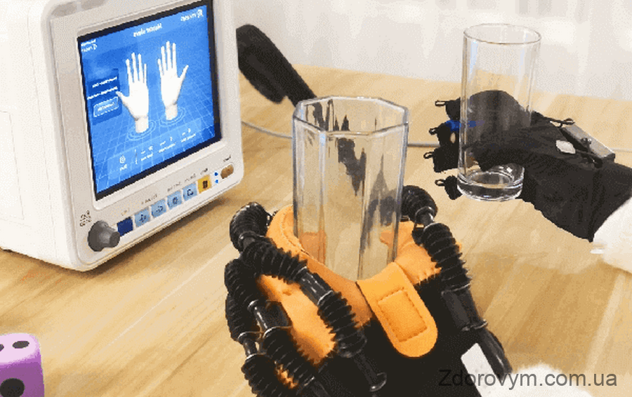 Роботизована рукавичка для механотерапії