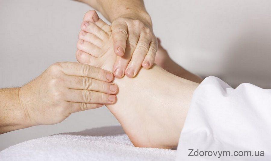 Лікування кісточки на великому пальці ноги